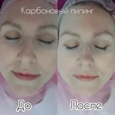 Студия эпиляции Топлазер про фотография 5