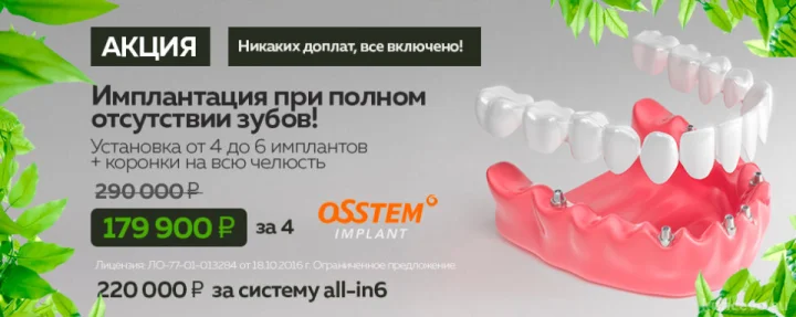 Имплантация all-in-4-6 зубов под ключ — цена 179 900 рублей